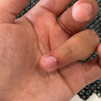 Nail House Nef22 Protez Tırnak Ve Tırnak Etlerimin Kan İçinde Kalması