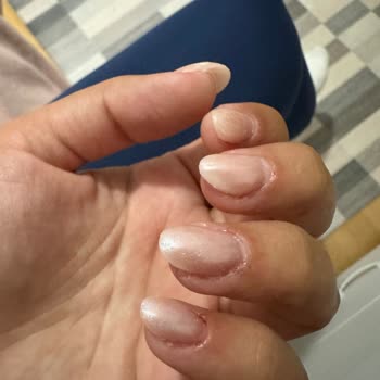 Nail House Nef22 Protez Tırnak Ve Tırnak Etlerimin Kan İçinde Kalması