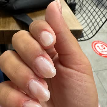 Nail House Nef22 Protez Tırnak Ve Tırnak Etlerimin Kan İçinde Kalması