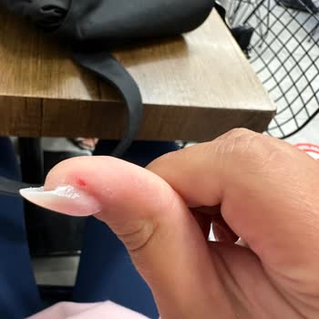 Nail House Nef22 Protez Tırnak Ve Tırnak Etlerimin Kan İçinde Kalması