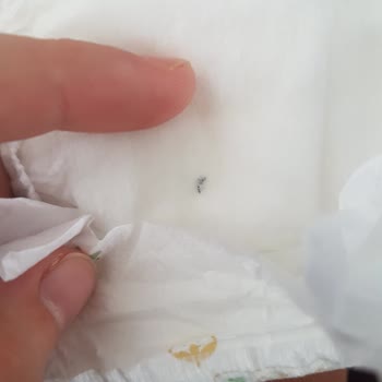 Baby Turco Bez İçinde Bilinmeyen Cisim