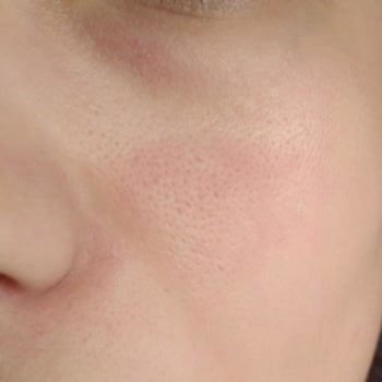 S'HE Vec Markalı Bozulmuş C Vitamini Serumu Yüzümü Mahvetti