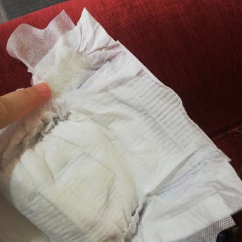 Molfix Bebek Bezi Sert Cisim