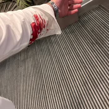 Topkapı Koç Hastanesi'ndeki Kan Alma İşlemi