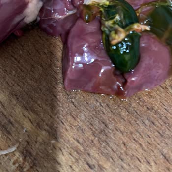 A101 Keskinoğlu Ciğer Öd Patlaması