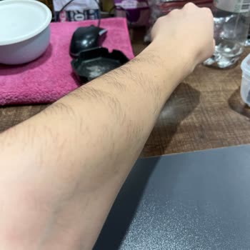 Arzu Yılmaz Güzellik Merkezi Epilasyon Hizmetinde Yaşanan Sorunlar