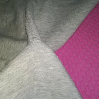 Mavi Marka Aşırı Tüylenme