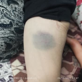 İnayet Topçuoğlu Hastanesi'nden Şikayetçiyim