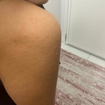 La Roche Posay Lipikar Baume Alerji