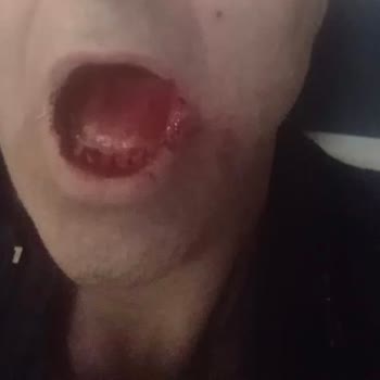 Pendik Ağız Ve Diş Sağlığı Hastanesi Hastanın Mağdur Etmesi