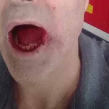 Pendik Ağız Ve Diş Sağlığı Hastanesi Hastanın Mağdur Etmesi