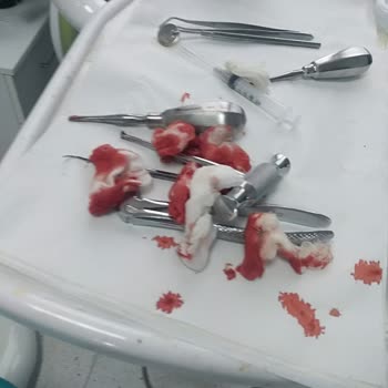 Pendik Ağız Ve Diş Sağlığı Hastanesi Hastanın Mağdur Etmesi