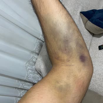 Türk Kızılay Damar Yolundan Kan Alma
