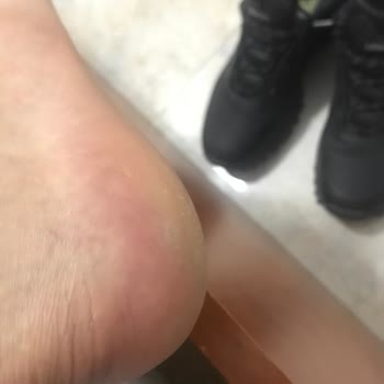 Lescon Ayakkabı İade Ve Onarım Problemi.