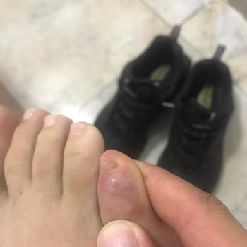 Lescon Ayakkabı İade Ve Onarım Problemi.