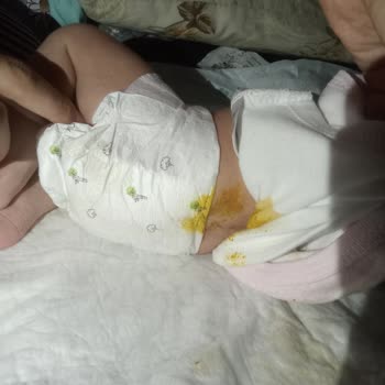 Sleepy Sahte Ürün Yolladı