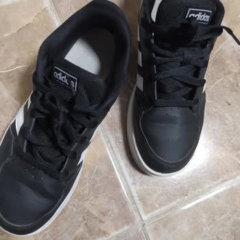 Adidas Ayakkabı Üretim Hatası Kızımın Ayağını Yara Etti