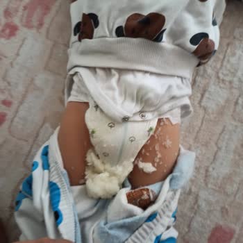 Sleepy Bebek Bezi Patlıyor