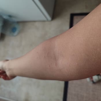 Bioblas Siyah Sarımsak Özlü Şampuan Alerji Yapıyor