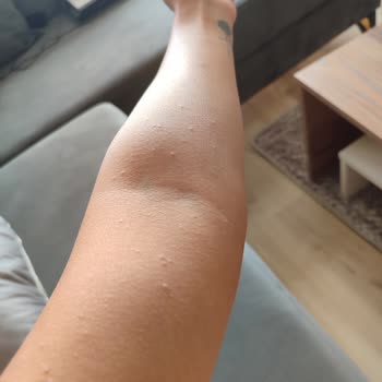 Bioblas Siyah Sarımsak Özlü Şampuan Alerji Yapıyor