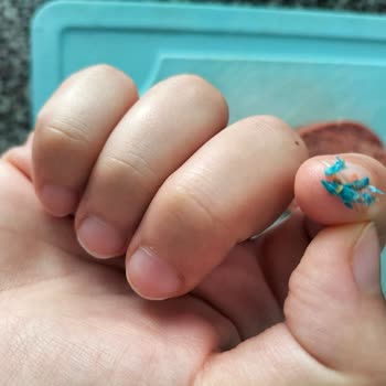 Köfteci Yusuf Sucuğunda Yabancı Cisim