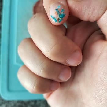 Köfteci Yusuf Sucuğunda Yabancı Cisim