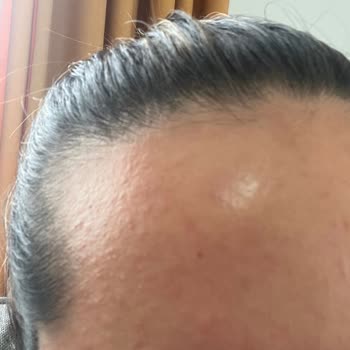 Cream Co Nemlendirici Krem Alerji Yaptı