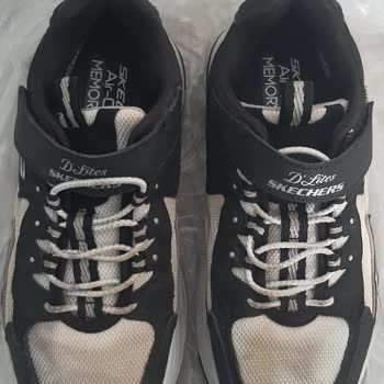 Skechers Ayakkabı Renk Geçişi Ve Garanti İlgisizliği