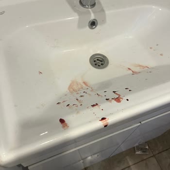 Işıklı Mimarlık Blue Garden Samandıra Anahtar Tesliminin Bir Türlü Yapılmaması