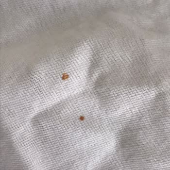 Gaziantep Profilo Yetkili Servis Ve Çamaşır Makinesi Sorunu