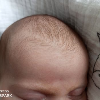 Mustela Bebek Şampuanı Bebeğimin Cildini Tahriş Etti!