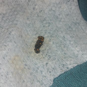 Doritos Cips Paketi İçerisinde Değişik Cisim Çıktı