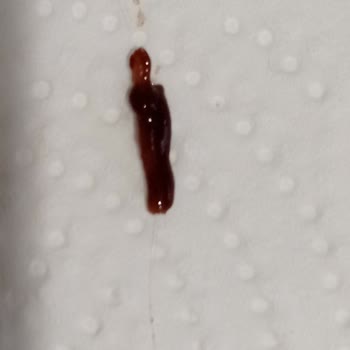 BİM Yiyeceğin İçinden Çıkan Yabancı Madde