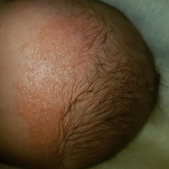 Bioderma Atoderm İntensive Baume