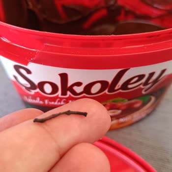 A101 Yabancı Cisim Çıktı