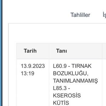 Eki aç