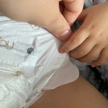 Pure Baby Bezle İlgili Cırt Kısmı Sorunu