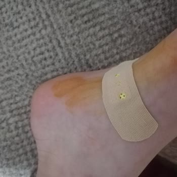 FLO Ayakkabı FLO'dan Alınan Çocuk Çorabından Raptiye Çıktı.