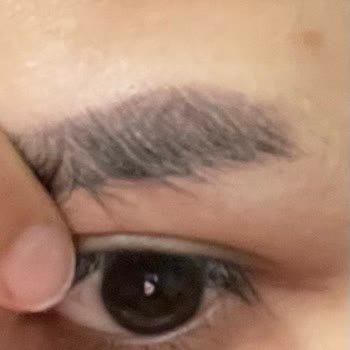 Note Cosmetics Note Kaş Vaksı Alerjik Reaksiyon