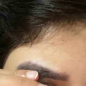 Note Cosmetics Note Kaş Vaksı Alerjik Reaksiyon