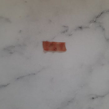 Beşler Sucuktan Yabancı Cisim Çıktı