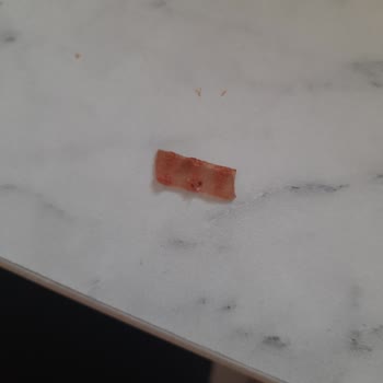 Beşler Sucuktan Yabancı Cisim Çıktı