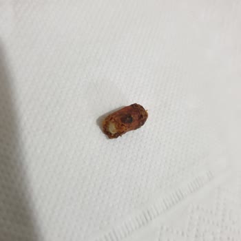 Faruk Güllüoğlu Tatlılardan Fıstık Kabuğu Çıkıyor