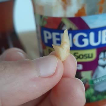 Penguen Markasının Sosu Yüzünden Dişimden Oldum!