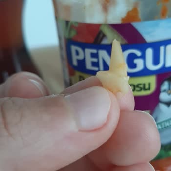 Penguen Markasının Sosu Yüzünden Dişimden Oldum!