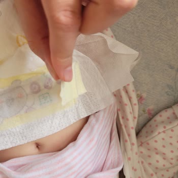 Prima Premium Care Bantları Kopup Sızdırma Yaptı