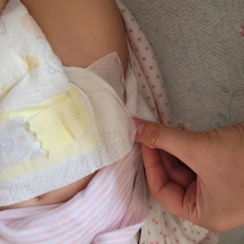 Prima Premium Care Bantları Kopup Sızdırma Yaptı