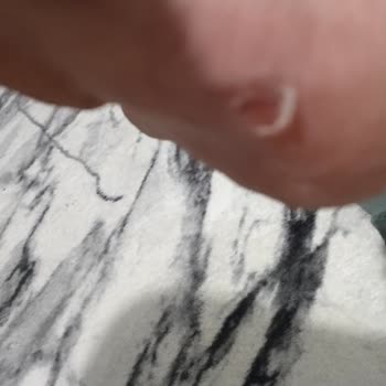 FLO Ayakkabı Ayakkabıdan Zarar Gördüm