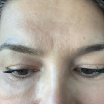 Linemed Aesthetic Linemed Ataşehir Gözaltı Şişliği