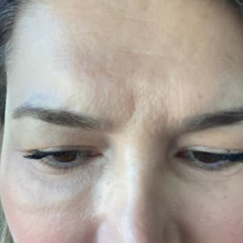 Linemed Aesthetic Linemed Ataşehir Gözaltı Şişliği